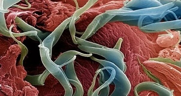 Towards the human body
